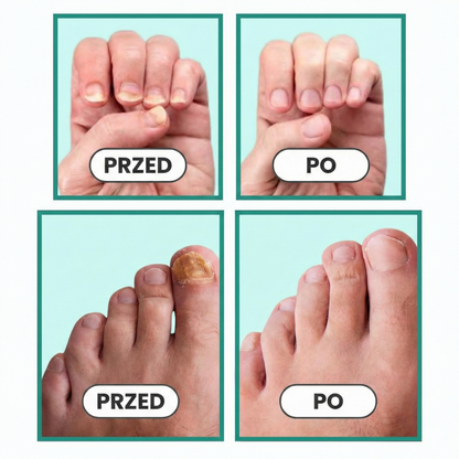 Urządzenie OrtoVital