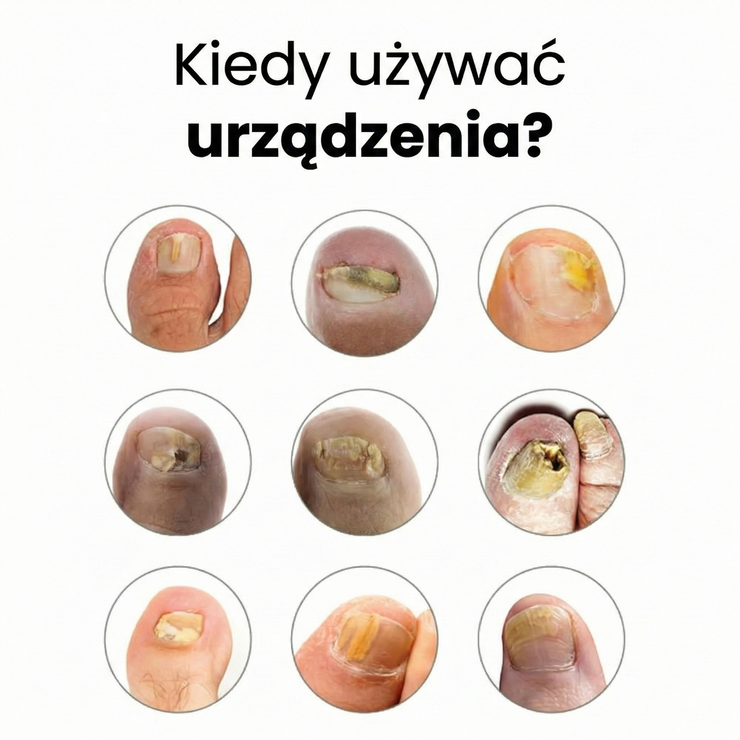 Urządzenie OrtoVital